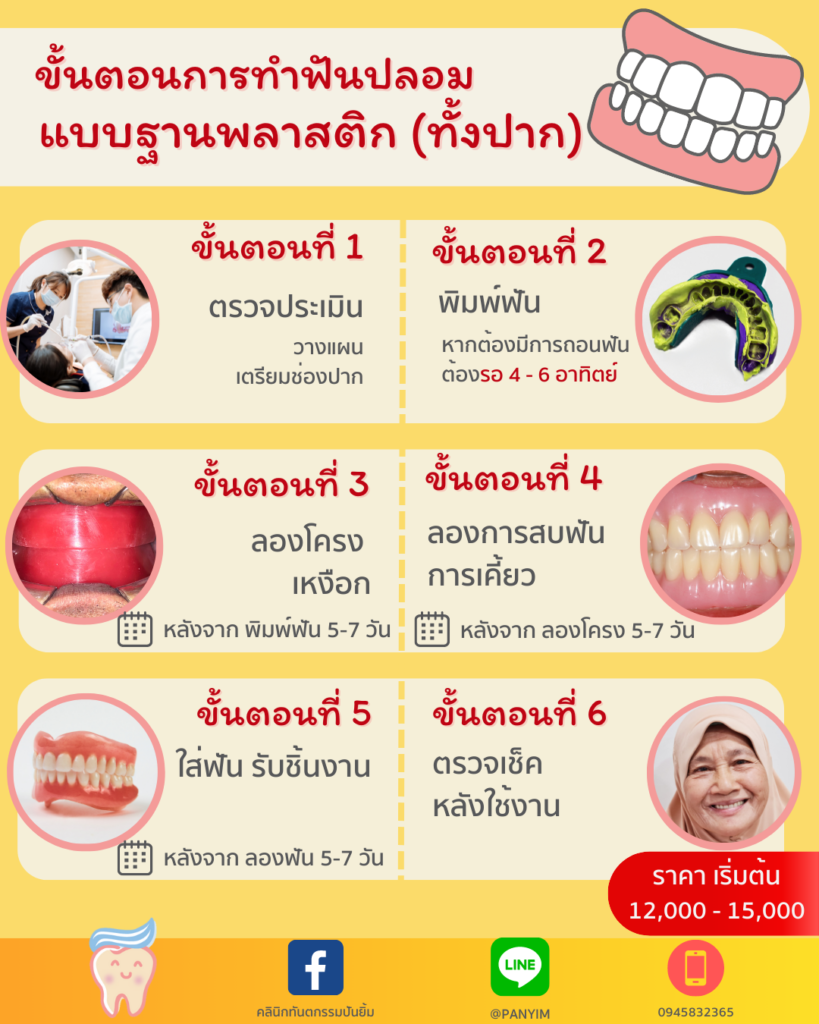 วิธีทำฟันปลอม