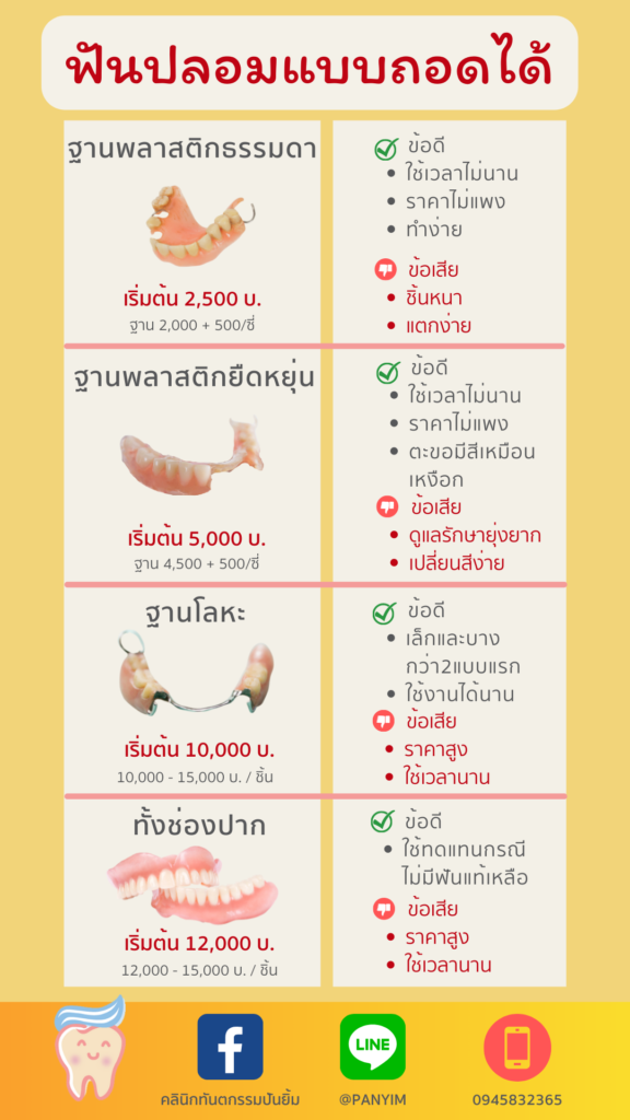 ฟันปลอม ถอดได้