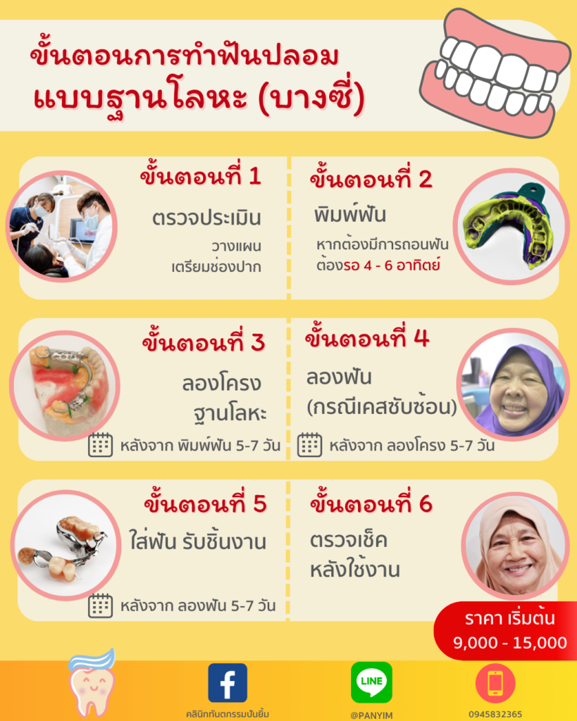 วิธีทำฟันปลอม