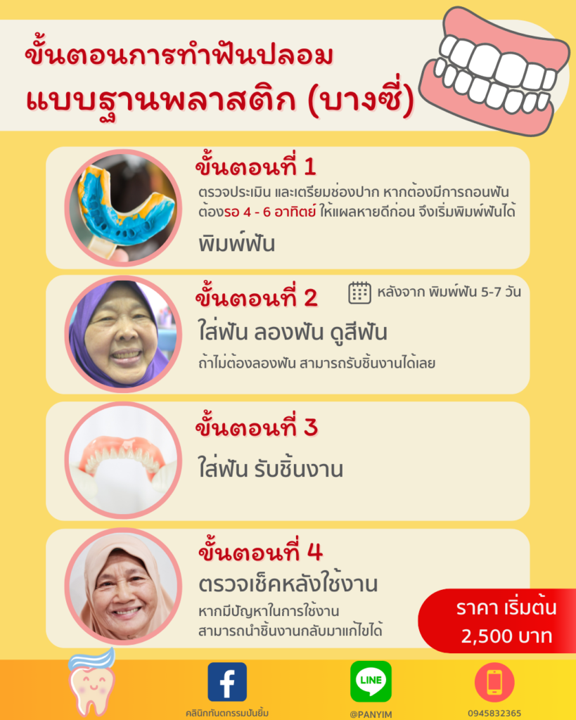วิธีทำฟันปลอม