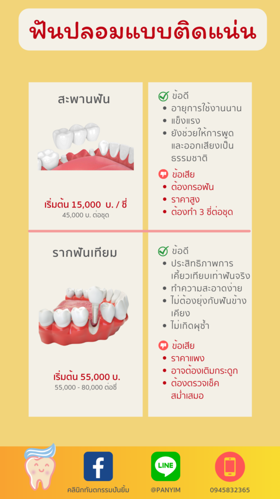 ฟันปลอมติดแน่น