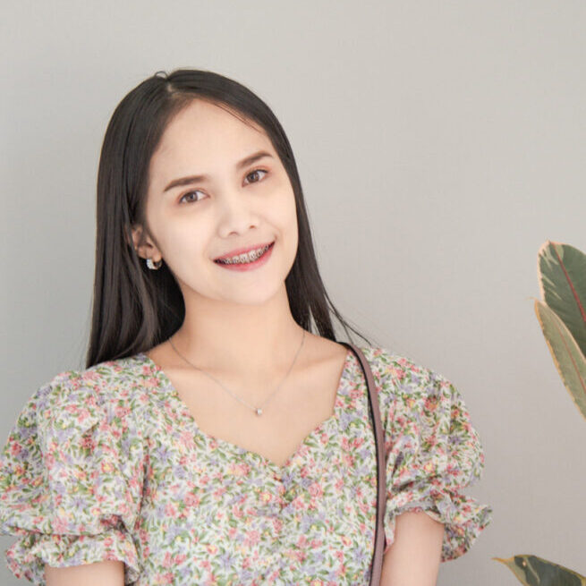 รีวิวจัดฟัน