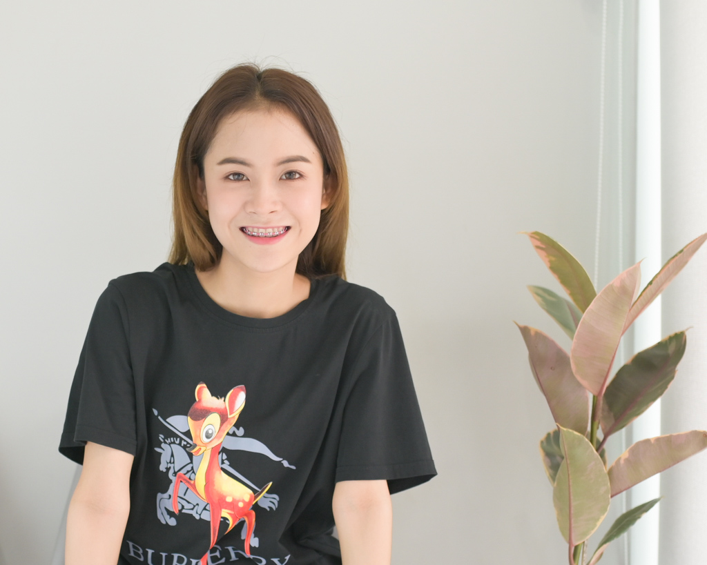 รีวิวจัดฟัน
