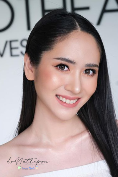 คลินิกทันตกรรมปันยิ้ม