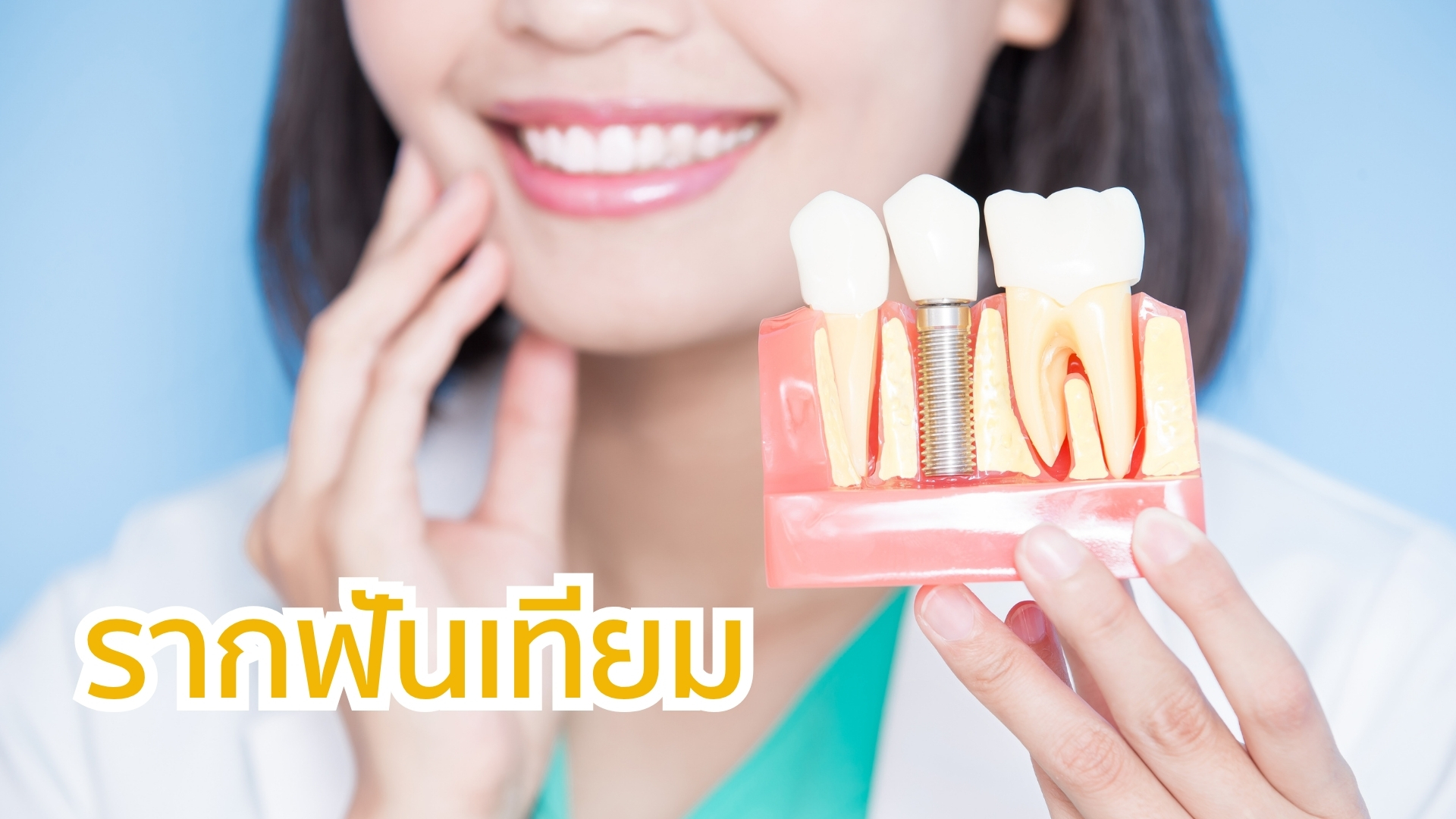 รากฟันเทียม คลินิกปันยิ้ม