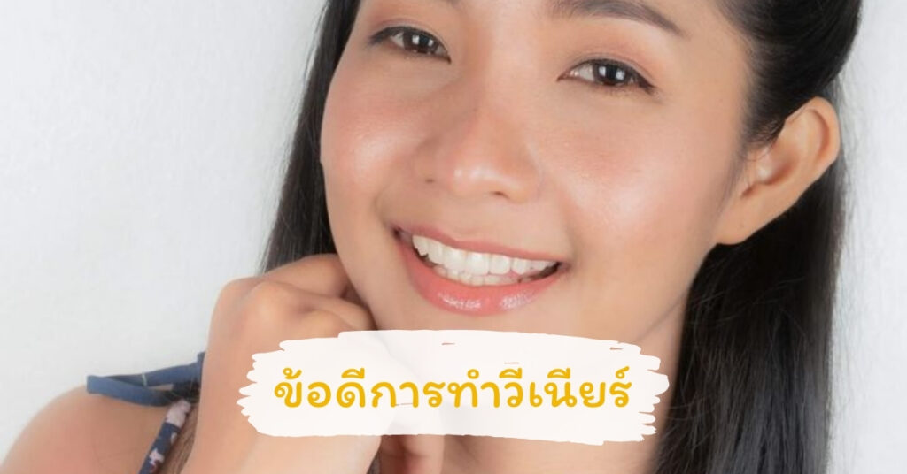 9 ข้อดีของการทำวีเนียร์