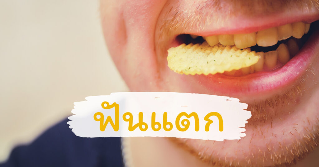 ฟันแตก ฟันบิ่น ฟันหัก ราคาเท่าไหร่ ต้องทำอย่างไร?