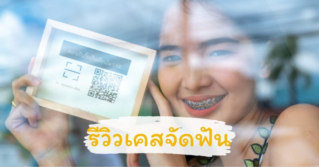 รีวิวเคสจัดฟัน